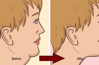 If You Have Double Chin Problems, You Can Do These Natural Things At Home…