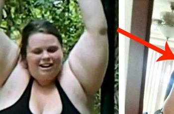 This Lady Shows The “Ugly Reality” Of Extreme Weight Loss