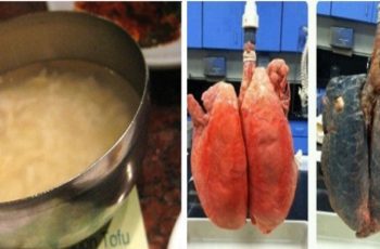 This Recipe Will Help Clear Your Lungs If You Have Been Smoking For More Than Five Years