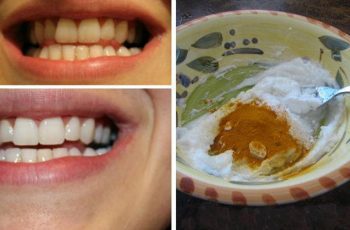 If You Have Gum And Teeth Issues, See What Can Happen With This Homemade Toothpaste…