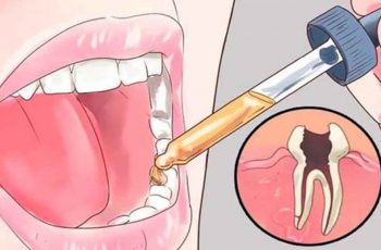 natural toothache remedies
