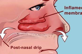 Get Rid Of Your Stuffy Nose With A Lymph Draining Massage